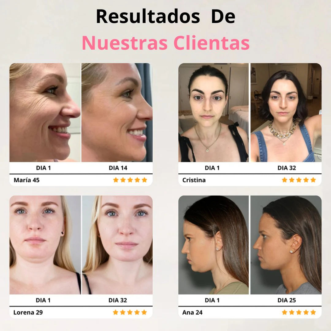 Auralis +