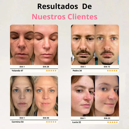 Auralis +