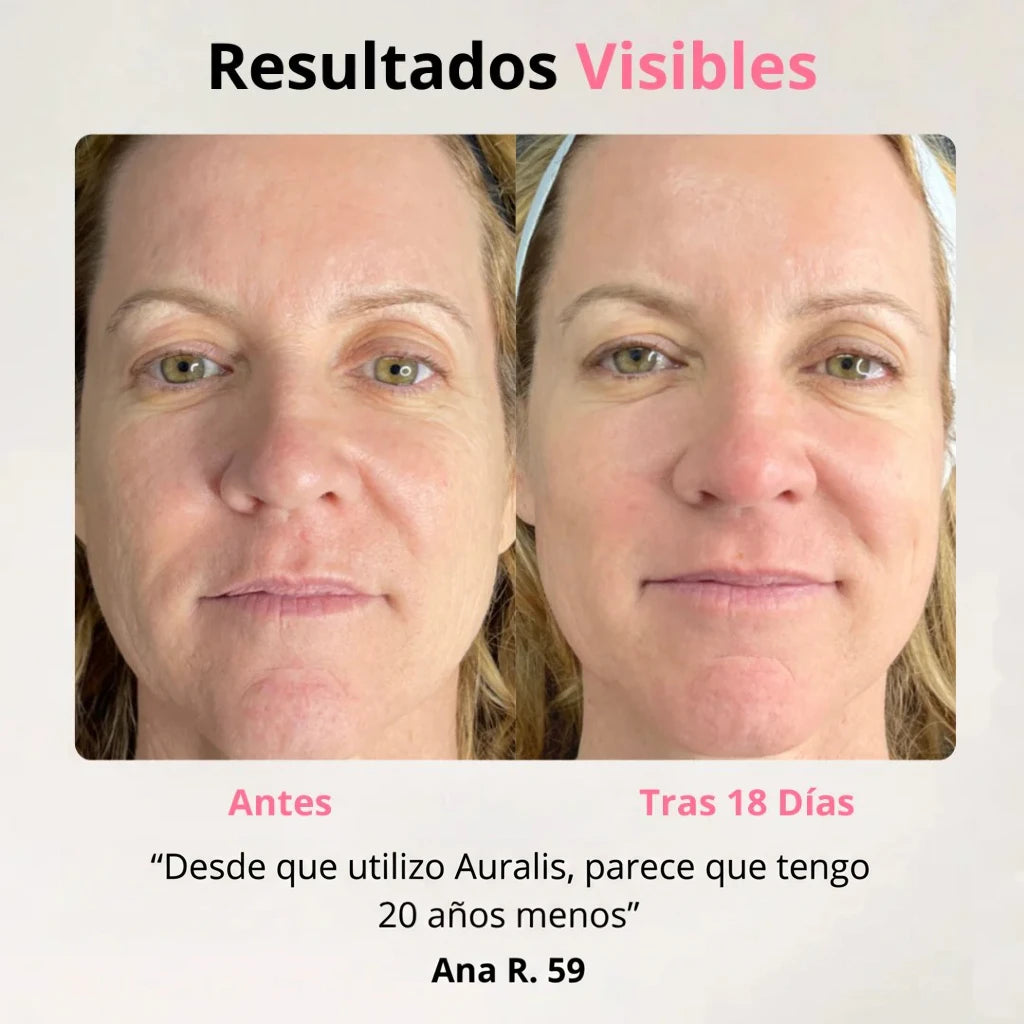 Auralis +